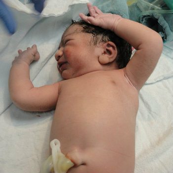 newborn baby in delivery room